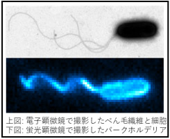 上図：電子顕微鏡で撮影したべん毛繊維と細胞、下図：蛍光顕微鏡で撮影したバークホルデリアの図